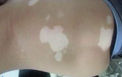 ������ʳ�ϵ����ע������