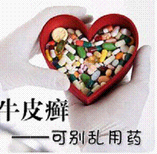 得了牛皮癣能快点治好吗