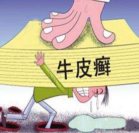 牛皮癣的发病原因有几种